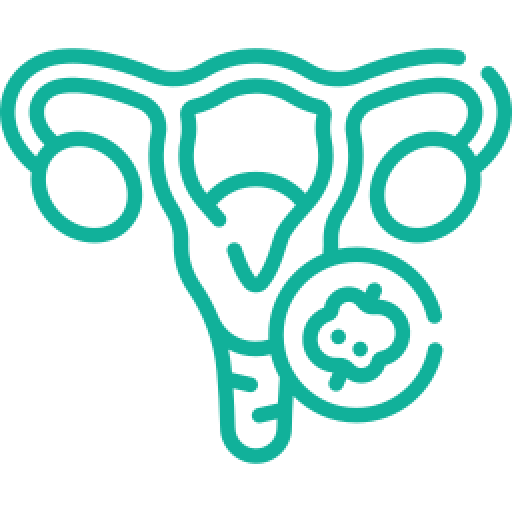 Polycystic-Ovarian-Syndrome_teal